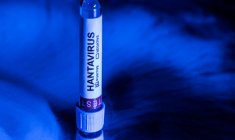 Hantavirus: pour les experts, le défi d'informer sans réveiller la peur du Covid ( AFP / Joel Saget )